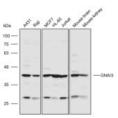 Solarbio K110816P Anti-GNAI3 Polyclonal Antibody
