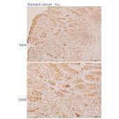 Solarbio K110715P Anti-CNKSR3 Polyclonal Antibody