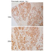 Solarbio K111015P Anti-NLRP12 Polyclonal Antibody