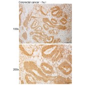 Solarbio K111105P Anti-ITGB5 Polyclonal Antibody