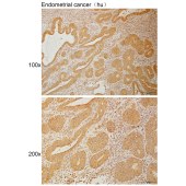 Solarbio K110947P Anti-MAP3K6 Polyclonal Antibody