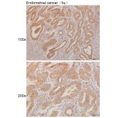Solarbio K111261P Anti-GPR42 Polyclonal Antibody