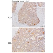 Solarbio K111485P Anti-DCLK2 Polyclonal Antibody
