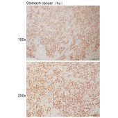 Solarbio K111012P Anti-BACH1 Polyclonal Antibody