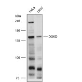 Solarbio K111633P Anti-DGKD Polyclonal Antibody