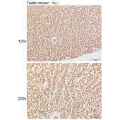 Solarbio K111644P Anti-DDX39A/B Polyclonal Antibody