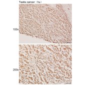Solarbio K111930P Anti-CDKN2C Polyclonal Antibody