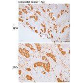 Solarbio K111763P Anti-B3GAT3 Polyclonal Antibody