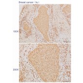 Solarbio K110584P Anti-NXF2 Polyclonal Antibody