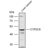 Solarbio K111239P Anti-CYP2C9 Polyclonal Antibody