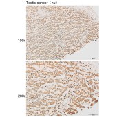 Solarbio K111855P Anti-OR5L1/2 Polyclonal Antibody