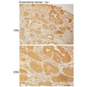 Solarbio K110968P Anti-OPHN1 Polyclonal Antibody