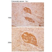 Solarbio K111697P Anti-CRYAA Polyclonal Antibody