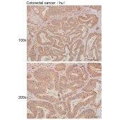 Solarbio K111276P Anti-ARMCX1 Polyclonal Antibody