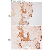 Solarbio K112106P Anti-HLA-DRA Polyclonal Antibody