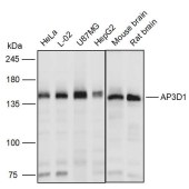 Solarbio K110999P Anti-AP3D1 Polyclonal Antibody