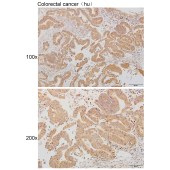 Solarbio K111282P Anti-CDH5 Polyclonal Antibody