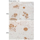 Solarbio K111969P Anti-KRT4 Polyclonal Antibody