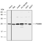 Solarbio K111973P Anti-PSMB9 Polyclonal Antibody