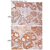 Solarbio K111774P Anti-IL23R Polyclonal Antibody
