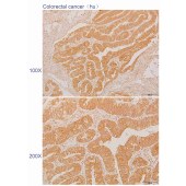 Solarbio K110598P Anti-PTPN9 Polyclonal Antibody