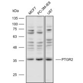 Solarbio K111023P Anti-PTGR2 Polyclonal Antibody