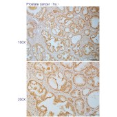 Solarbio K110841P Anti-RFX3 Polyclonal Antibody