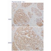 Solarbio K110540P Anti-DYNLRB1 Polyclonal Antibody