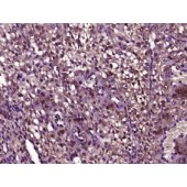 Solarbio K009919P Anti-Osterix Polyclonal antibody