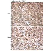 Solarbio K111974P Anti-GALNT7 Polyclonal Antibody