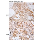 Solarbio K112131P Anti-TNFSF11 Polyclonal Antibody