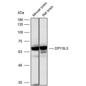 Solarbio K111659P Anti-DPYSL3 Polyclonal Antibody