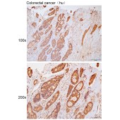 Solarbio K111769P Anti-TXNDC9 Polyclonal Antibody