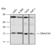 Solarbio K111032P Anti-DNAJC24 Polyclonal Antibody