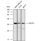 Solarbio K111907P Anti-HACD1 Polyclonal Antibody