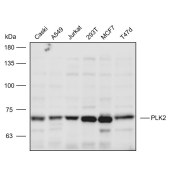 Solarbio K110827P Anti-PLK2 Polyclonal Antibody