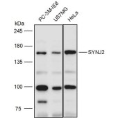 Solarbio K111453P Anti-SYNJ2 Polyclonal Antibody