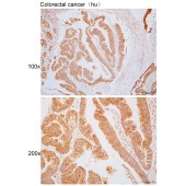 Solarbio K110611P Anti-TRIM38 Polyclonal Antibody
