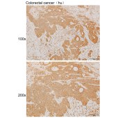 Solarbio K111915P Anti-SCOC Polyclonal Antibody