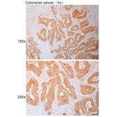 Solarbio K110902P Anti-HMMR Polyclonal Antibody