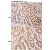 Solarbio K111110P Anti-CLCN7 Polyclonal Antibody