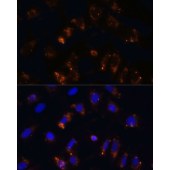 Solarbio K009992P Anti-TGFB1 Polyclonal Antibody