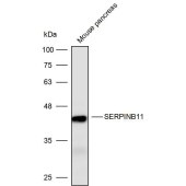 Solarbio K111684P Anti-SERPINB11 Polyclonal Antibody