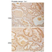 Solarbio K111016P Anti-RBM6 Polyclonal Antibody