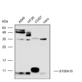 Solarbio K111621P Anti-S100A10 Polyclonal Antibody