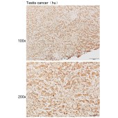Solarbio K111927P Anti-PRKAG1 Polyclonal Antibody