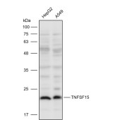 Solarbio K111623P Anti-TNFSF15 Polyclonal Antibody