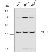 Solarbio K110971P Anti-VTI1B Polyclonal Antibody