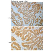 Solarbio K110833P Anti-FZD6 Polyclonal Antibody