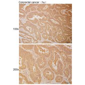 Solarbio K111030P Anti-PTER Polyclonal Antibody